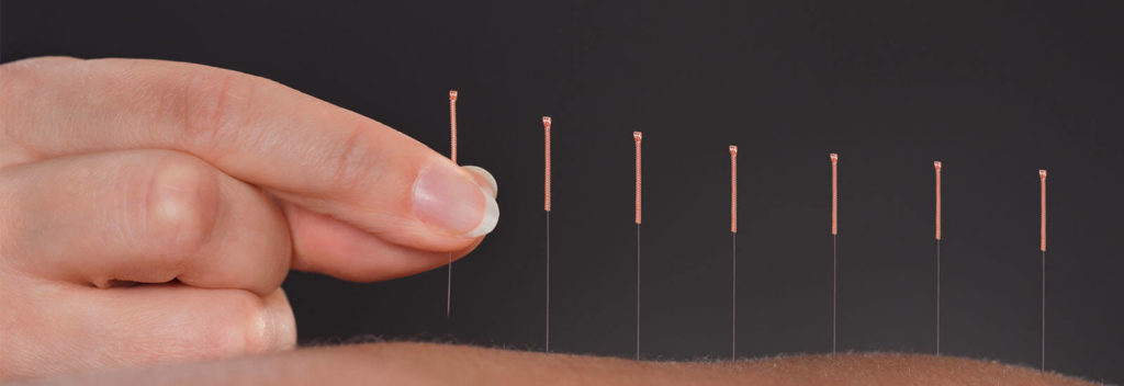 Acupuncture Dark