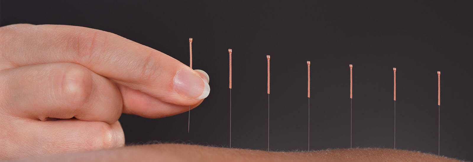 NYSHIP Covers Acupuncture Midtown AcuCare in NYC