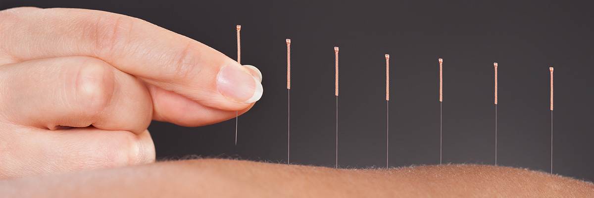 Acupuncturist in Midtown